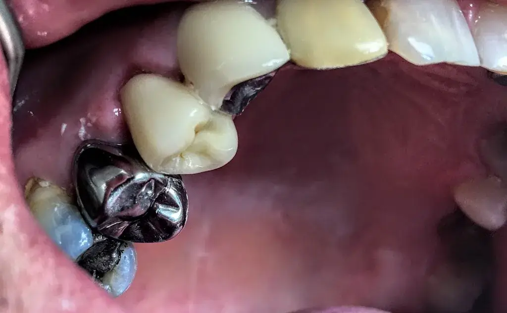 Dr El Amouri - Dentiste_Bazoches-les-Gallerandes_slider_image_2