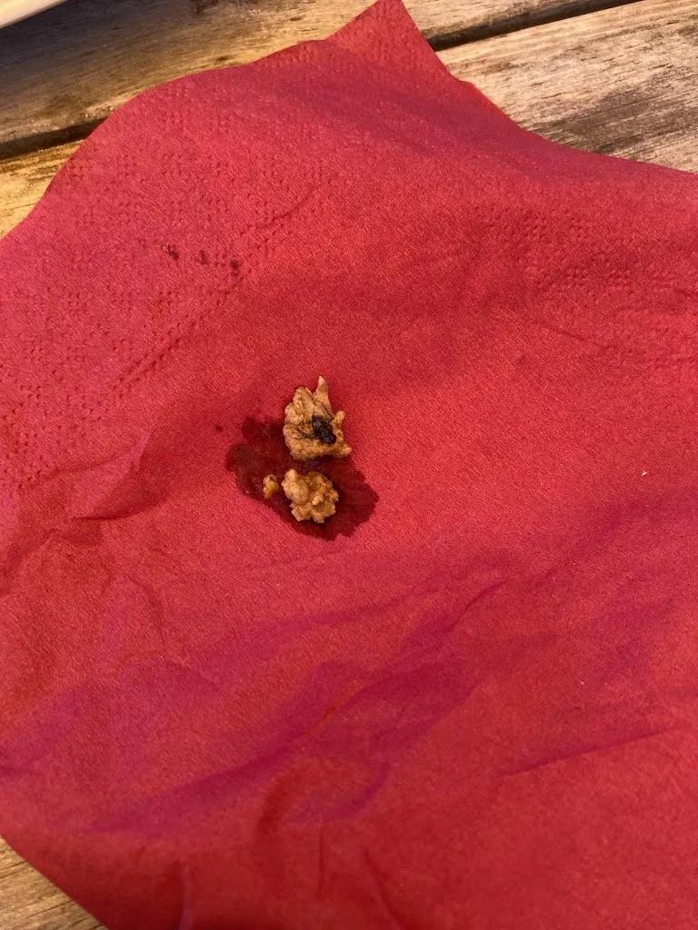 Ioana Trandafir_Restaurant Bar Konditorei Sarè_San Cassiano_review